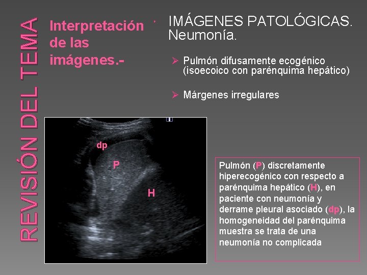 REVISIÓN DEL TEMA Interpretación IMÁGENES PATOLÓGICAS. Neumonía. de las Ø Pulmón difusamente ecogénico imágenes.