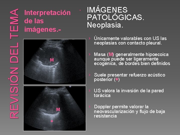 REVISIÓN DEL TEMA Interpretación de las imágenes. - IMÁGENES PATOLÓGICAS. Neoplasia. › Únicamente valorables