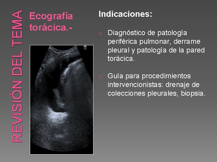 REVISIÓN DEL TEMA Ecografía torácica. - Indicaciones: o Diagnóstico de patología periférica pulmonar, derrame