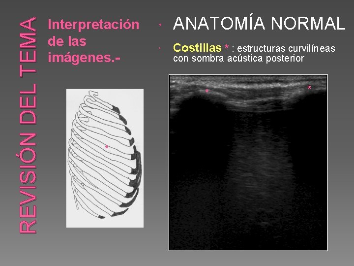 REVISIÓN DEL TEMA Interpretación de las imágenes. - ANATOMÍA NORMAL Costillas * : estructuras