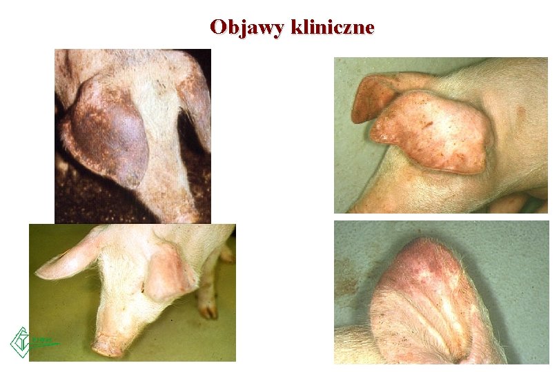 Objawy kliniczne 