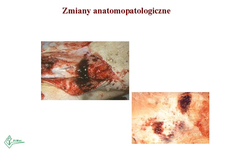 Zmiany anatomopatologiczne 