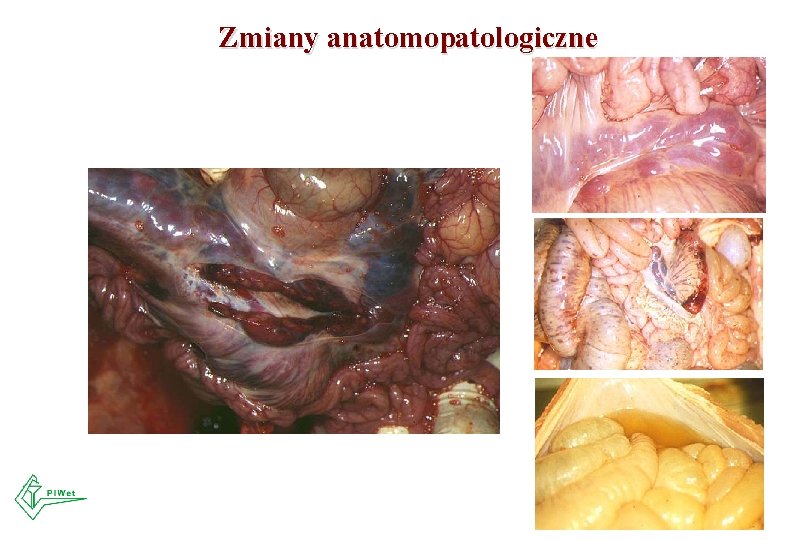 Zmiany anatomopatologiczne 