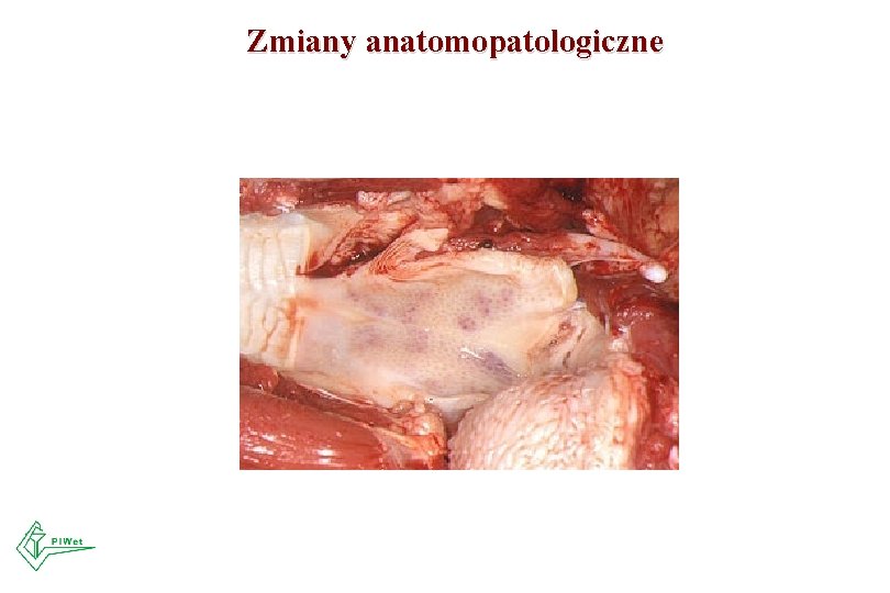 Zmiany anatomopatologiczne 