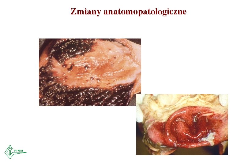 Zmiany anatomopatologiczne 