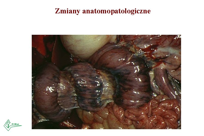 Zmiany anatomopatologiczne 