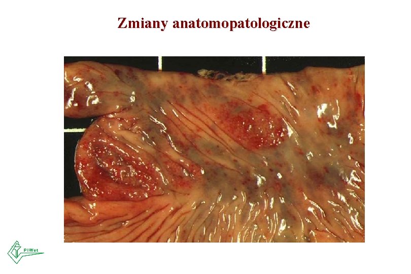 Zmiany anatomopatologiczne Zmiany anatomopatologiczne