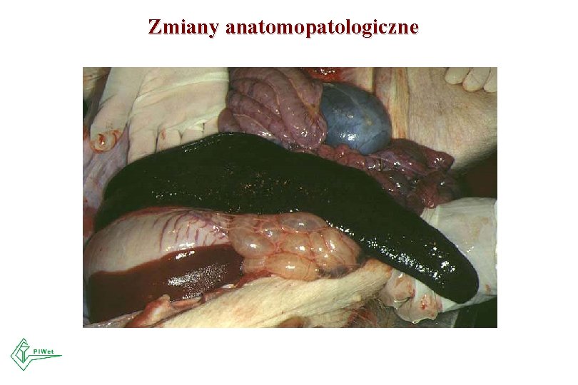 Zmiany anatomopatologiczne 