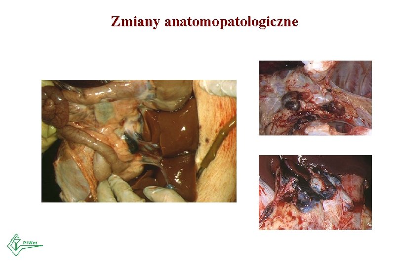 Zmiany anatomopatologiczne 