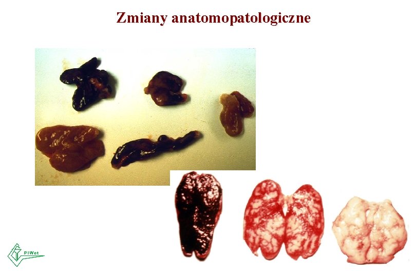 Zmiany anatomopatologiczne 