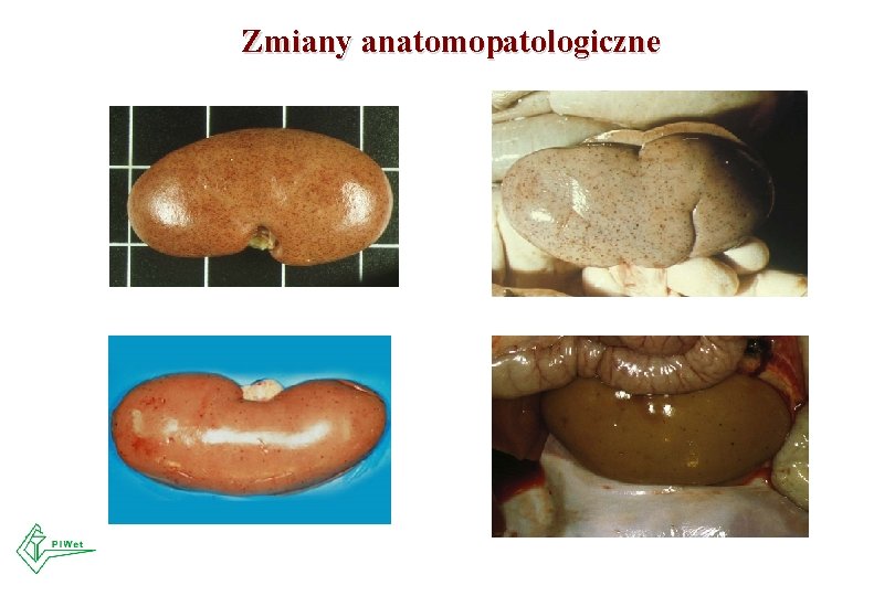 Zmiany anatomopatologiczne Zmiany anatomopatologiczne