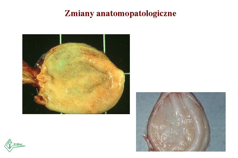 Zmiany anatomopatologiczne 