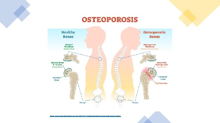 https: //www. bsrphysicaltherapy. com/2019/07/22/osteoporosis-back-strengthening-exercises/ 