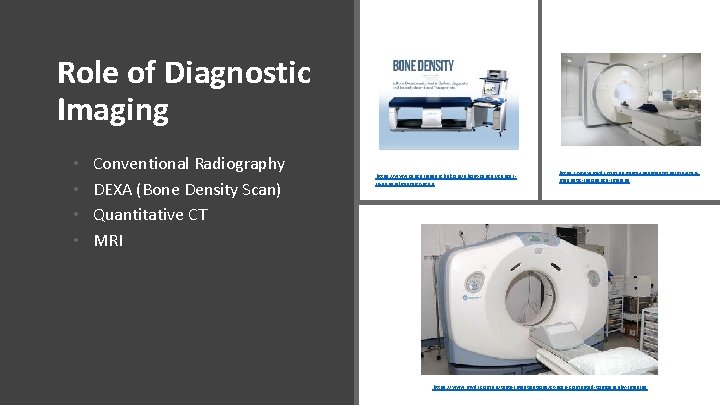 Role of Diagnostic Imaging • • Conventional Radiography DEXA (Bone Density Scan) Quantitative CT