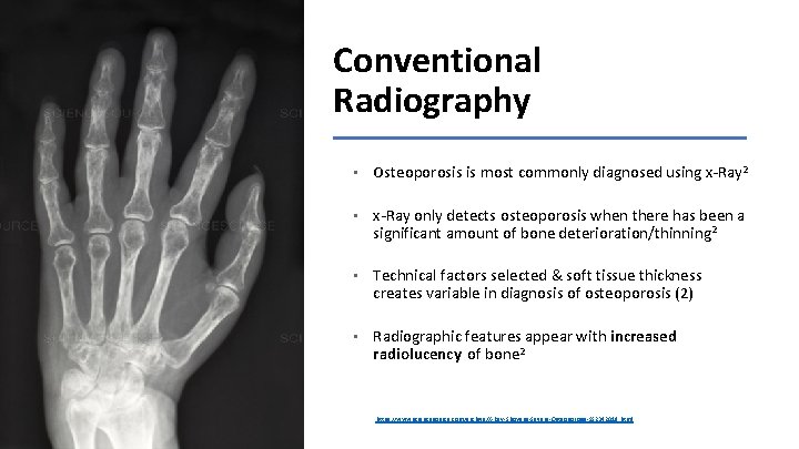 Conventional Radiography • Osteoporosis is most commonly diagnosed using x-Ray 2 • x-Ray only