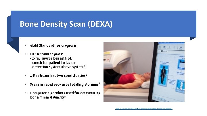 Bone Density Scan (DEXA) • Gold Standard for diagnosis • DEXA scanner parts: -