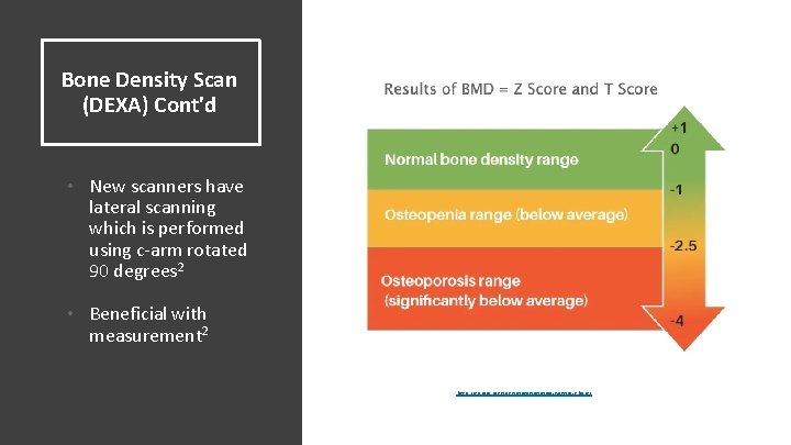 Bone Density Scan (DEXA) Cont'd • New scanners have lateral scanning which is performed