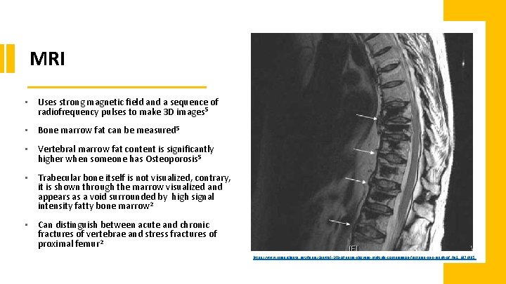 MRI • Uses strong magnetic field and a sequence of radiofrequency pulses to make