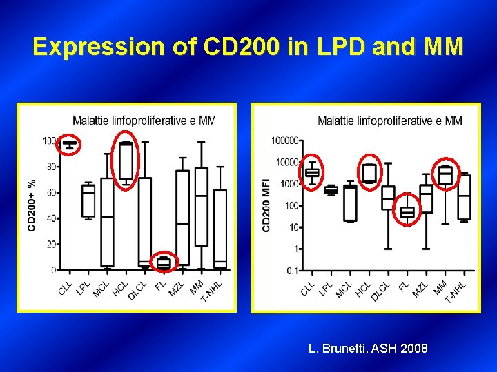 Expression of CD 200 in LPD and MM L. Brunetti, ASH 2008 