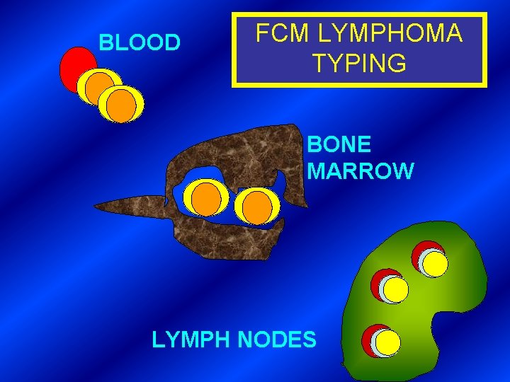 BLOOD FCM LYMPHOMA TYPING BONE MARROW LYMPH NODES 