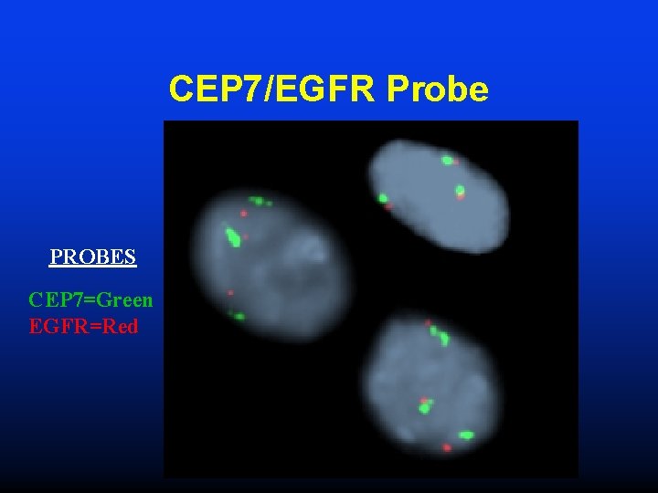 CEP 7/EGFR Probe PROBES CEP 7=Green EGFR=Red 