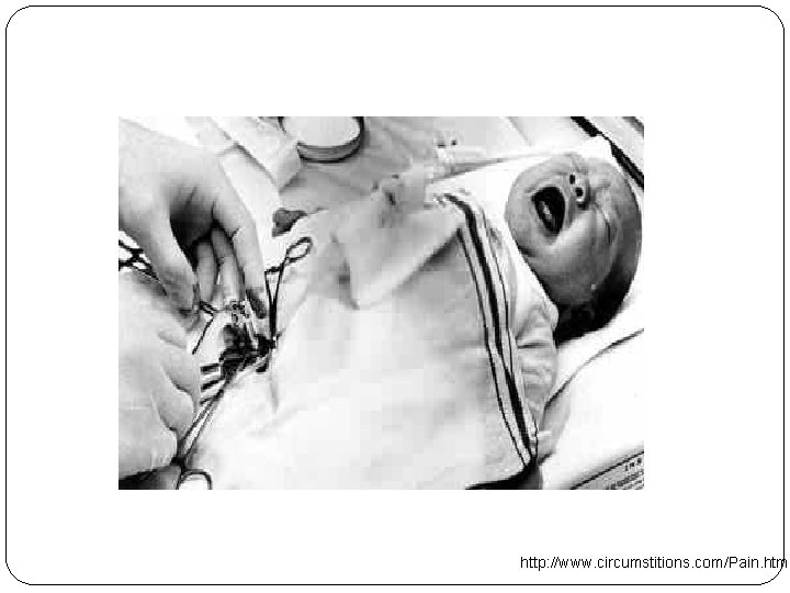 http: //www. circumstitions. com/Pain. html 