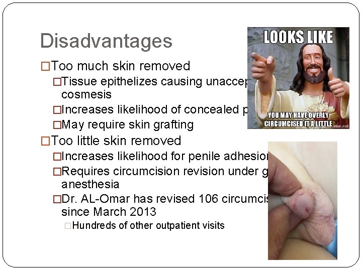 Disadvantages �Too much skin removed �Tissue epithelizes causing unacceptable cosmesis �Increases likelihood of concealed