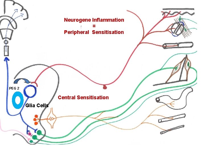 Neurogene Inflammation = Peripheral Sensitisation PEG 2 Central Sensitisation Glia Cells 