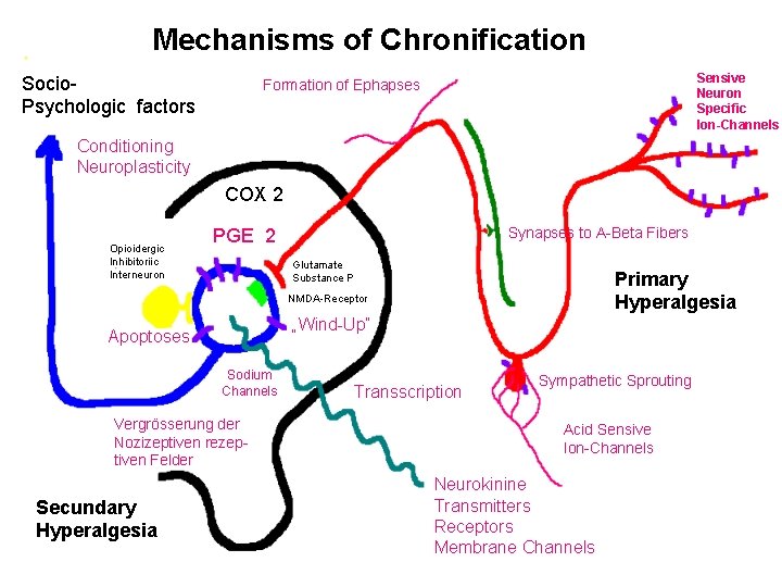 Mechanisms of Chronification Socio. Psychologic factors Sensive Neuron Specific Ion-Channels Formation of Ephapses Conditioning