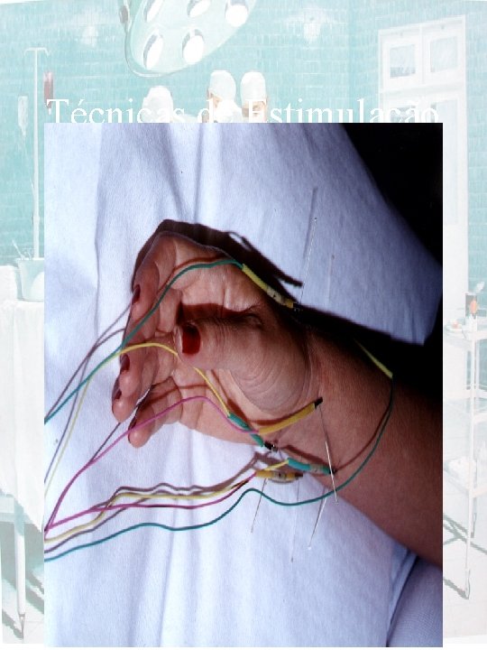 Técnicas de Estimulação 