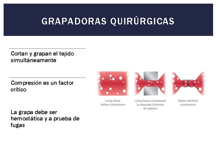 GRAPADORAS QUIRÚRGICAS Cortan y grapan el tejido simultáneamente Compresión es un factor crítico La