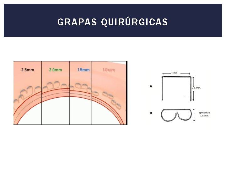 GRAPAS QUIRÚRGICAS 
