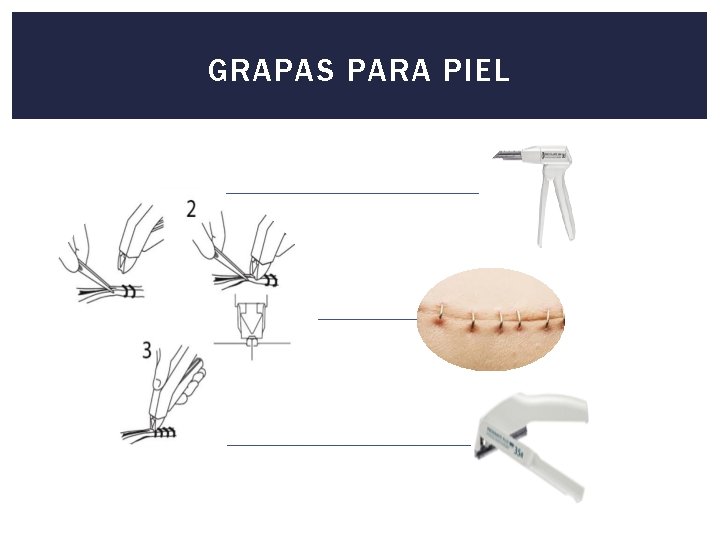 GRAPAS PARA PIEL 
