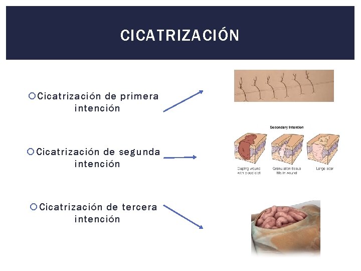 CICATRIZACIÓN Cicatrización de primera intención Cicatrización de segunda intención Cicatrización de tercera intención 
