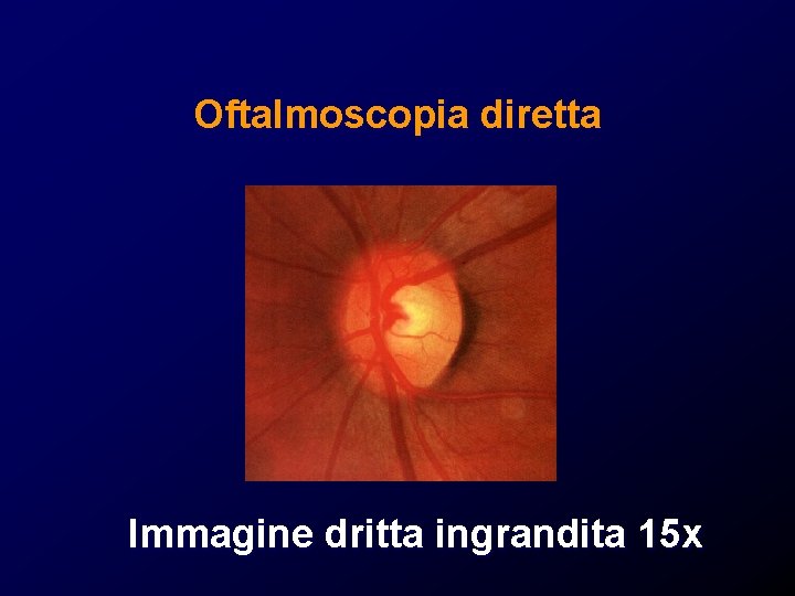 Oftalmoscopia diretta Immagine dritta ingrandita 15 x Oftalmoscopia diretta Immagine dritta ingrandita 15 x