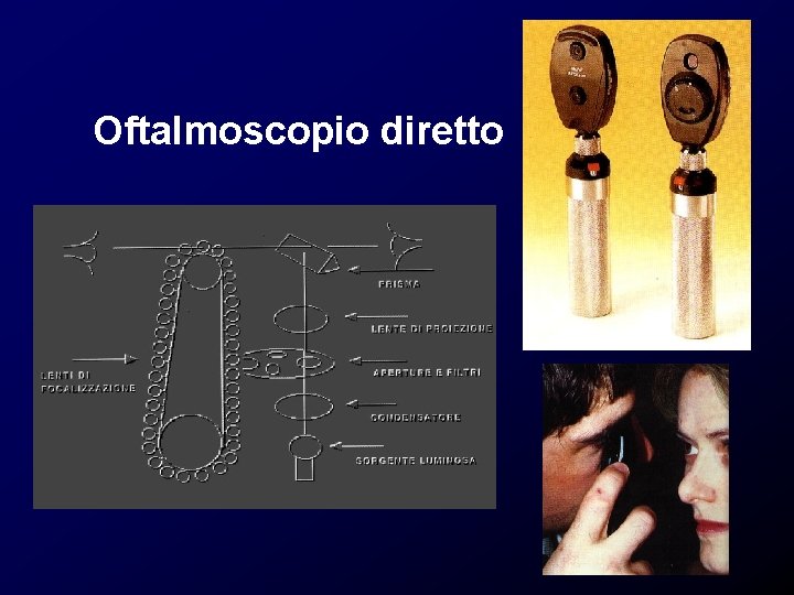 Oftalmoscopio diretto Oftalmoscopio diretto