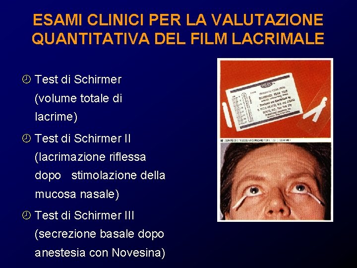 ESAMI CLINICI PER LA VALUTAZIONE QUANTITATIVA DEL FILM LACRIMALE ¾ Test di Schirmer (volume ESAMI CLINICI PER LA VALUTAZIONE QUANTITATIVA DEL FILM LACRIMALE ¾ Test di Schirmer (volume