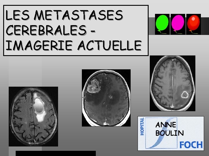 LES METASTASES CEREBRALES IMAGERIE ACTUELLE ANNE BOULIN 