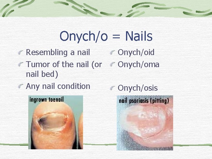 Onych/o = Nails Resembling a nail Tumor of the nail (or nail bed) Any