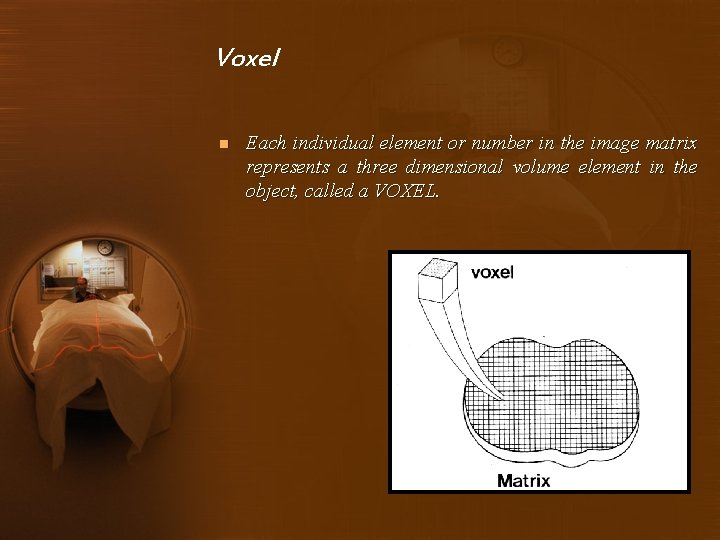 Voxel n Each individual element or number in the image matrix represents a three