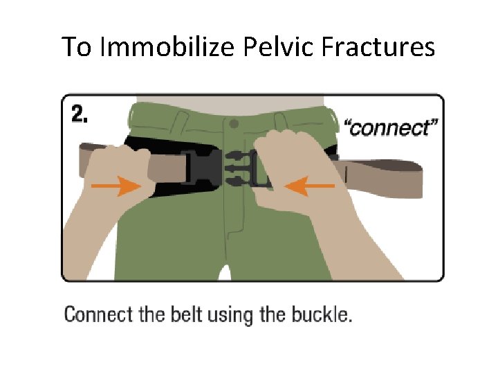 To Immobilize Pelvic Fractures 