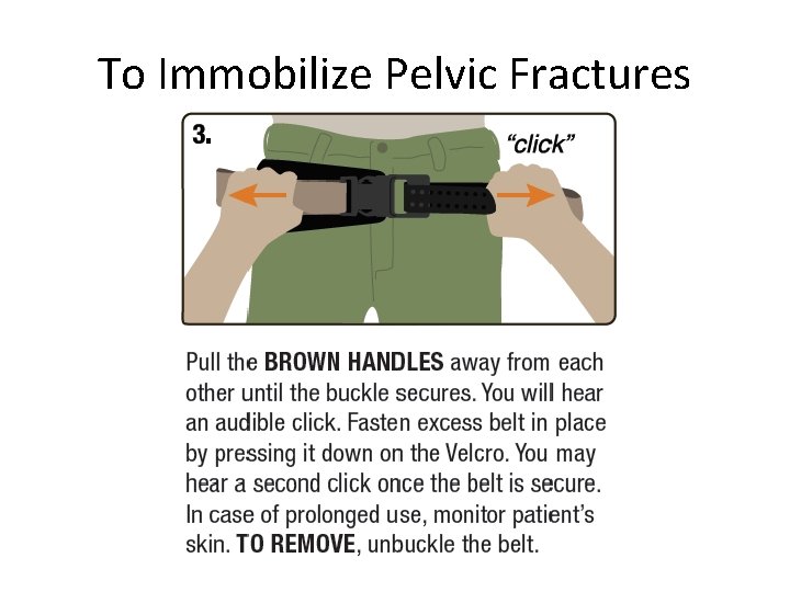 To Immobilize Pelvic Fractures 