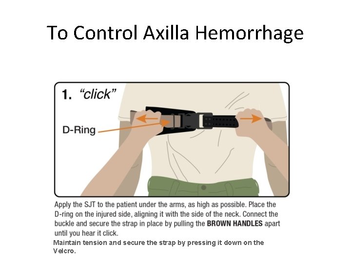 To Control Axilla Hemorrhage Maintain tension and secure the strap by pressing it down