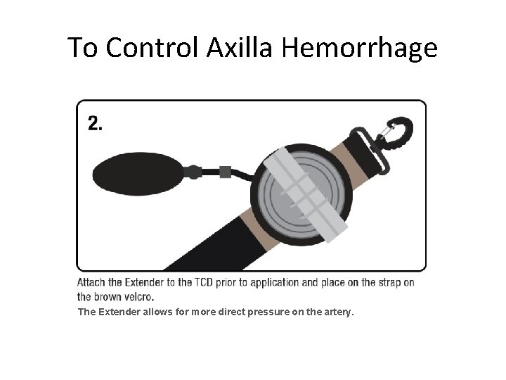 To Control Axilla Hemorrhage The Extender allows for more direct pressure on the artery.