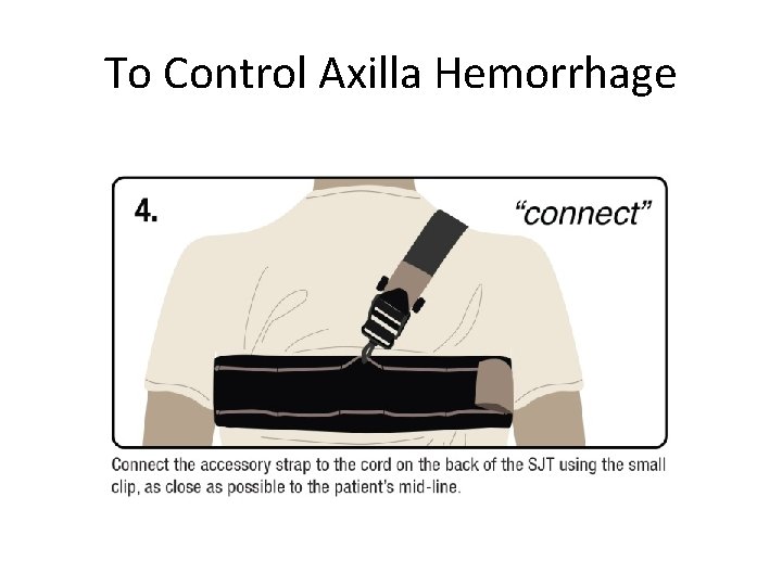To Control Axilla Hemorrhage 