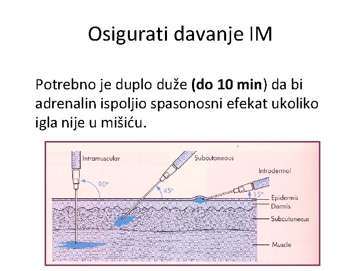 Osigurati davanje IM Potrebno je duplo duže (do 10 min) da bi adrenalin ispoljio