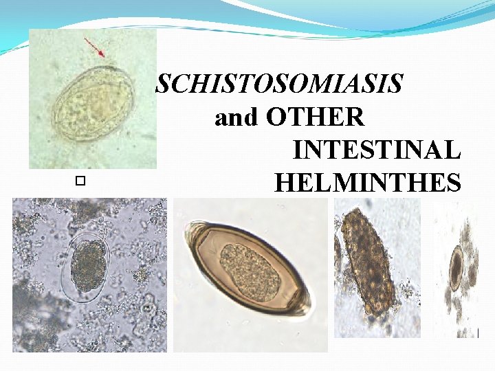  SCHISTOSOMIASIS and OTHER INTESTINAL HELMINTHES 