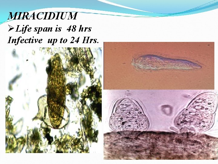 MIRACIDIUM ØLife span is 48 hrs Infective up to 24 Hrs. 