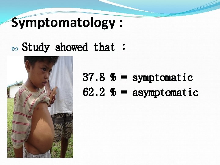 Symptomatology : Study showed that : 37. 8 % = symptomatic 62. 2 %