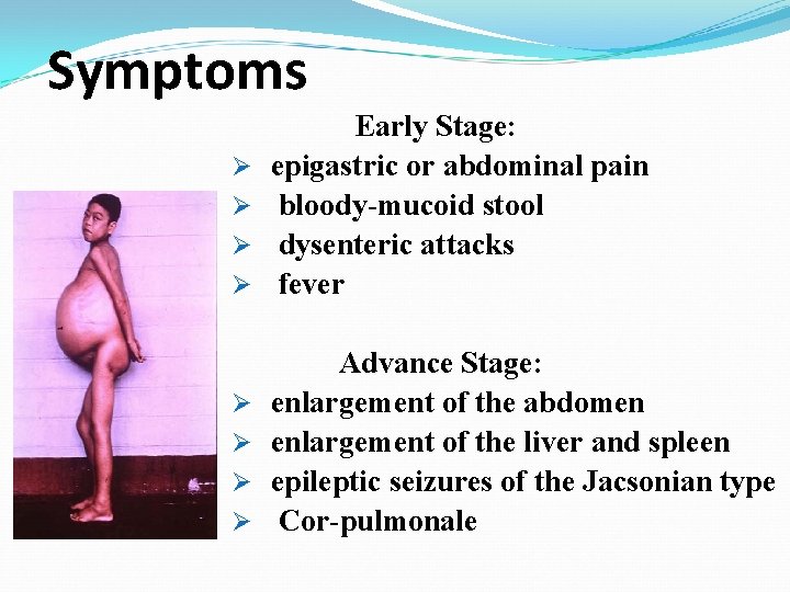 Symptoms Ø Ø Early Stage: epigastric or abdominal pain bloody-mucoid stool dysenteric attacks fever